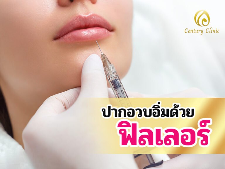 ปากอวบอิ่มด้วยฟิลเลอร์