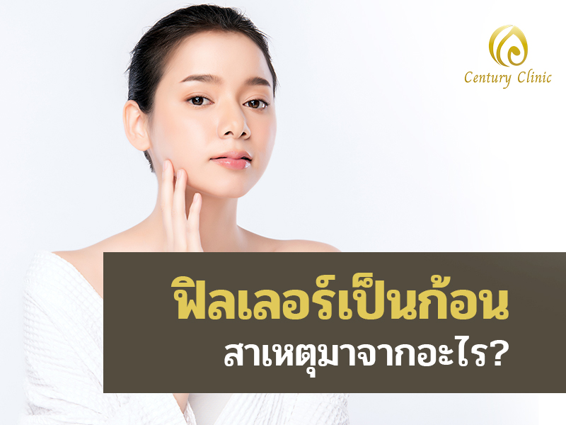 สาเหตุหลักของฟิลเลอร์เป็นก้อน , Century Clinic Thailand ฟิลเลอร์เป็นก้อนสาเหตุมาจากอะไร?