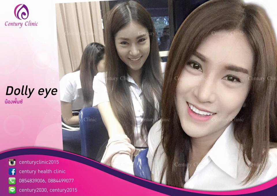 รีวิว Dolly eye #1 , Century Clinic Thailand รีวิว Dolly eye 1-CenturyClinic