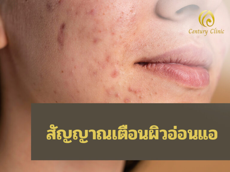 สัญญาณเตือนผิวอ่อนแอ