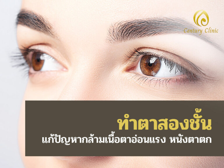 ทำตาสองชั้น แก้ปัญหากล้ามเนื้อตาอ่อนแรง หนังตาตก