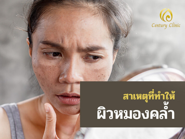 สาเหตุที่ทำให้ผิวหมองคล้ำ