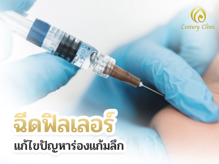 ฉีดฟิลเลอร์ แก้ไขปัญหาร่องแก้มลึก