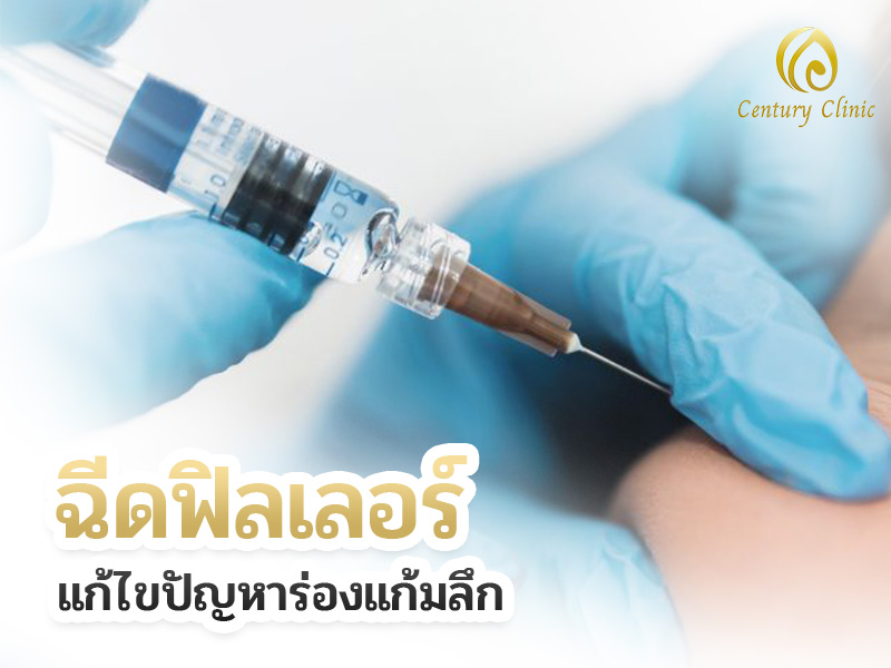 ฉีดฟิลเลอร์ แก้ไขปัญหาร่องแก้มลึก
