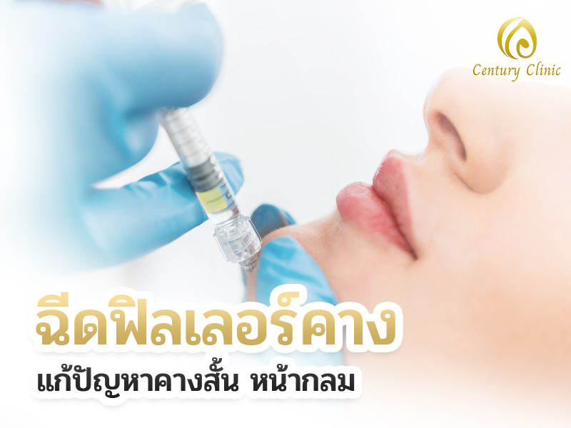 ฉีดฟิลเลอร์คาง แก้ปัญหาคางสั้น หน้ากลม