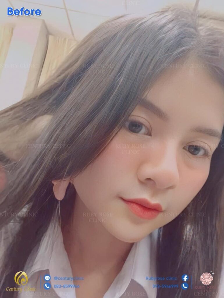 Century Clinic Thailand