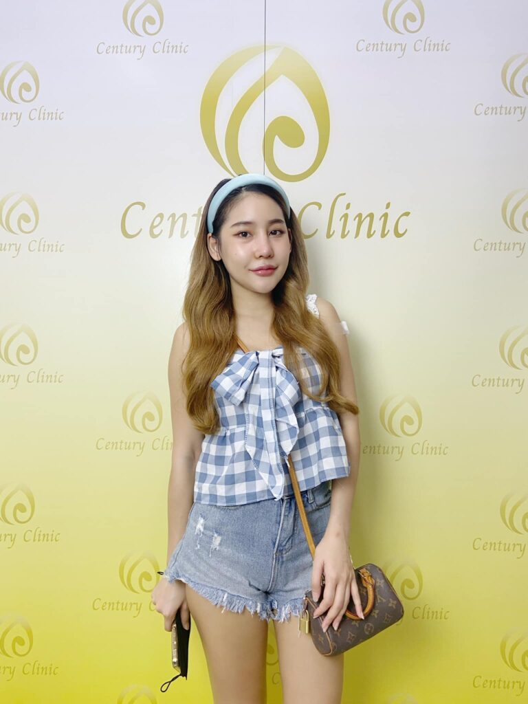 รีวิว แก้จมูก3 #48