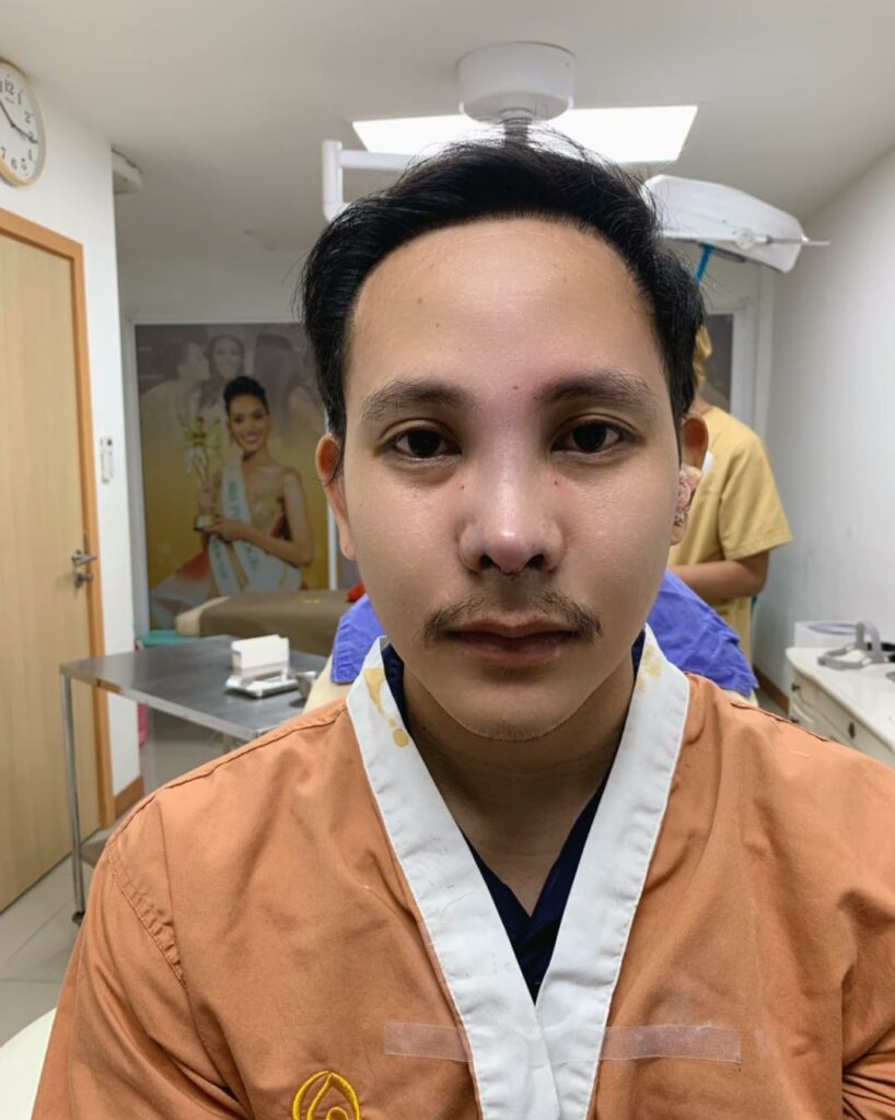 รีวิว แก้จมูก #237 , Century Clinic Thailand Century รีวิว แก้จมูก 1#237