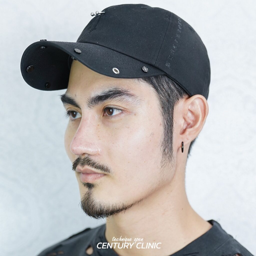 Century รีวิว แก้จมูก 2#261