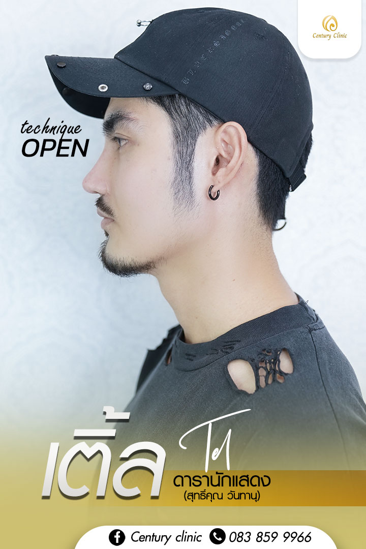 Century รีวิว แก้จมูก #261