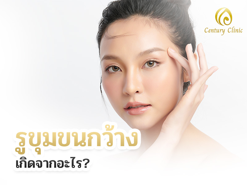 รูขุมขนกว้างเกิดจากอะไร? , Century Clinic Thailand รูขุมขนกว้างเกิดจากอะไร?