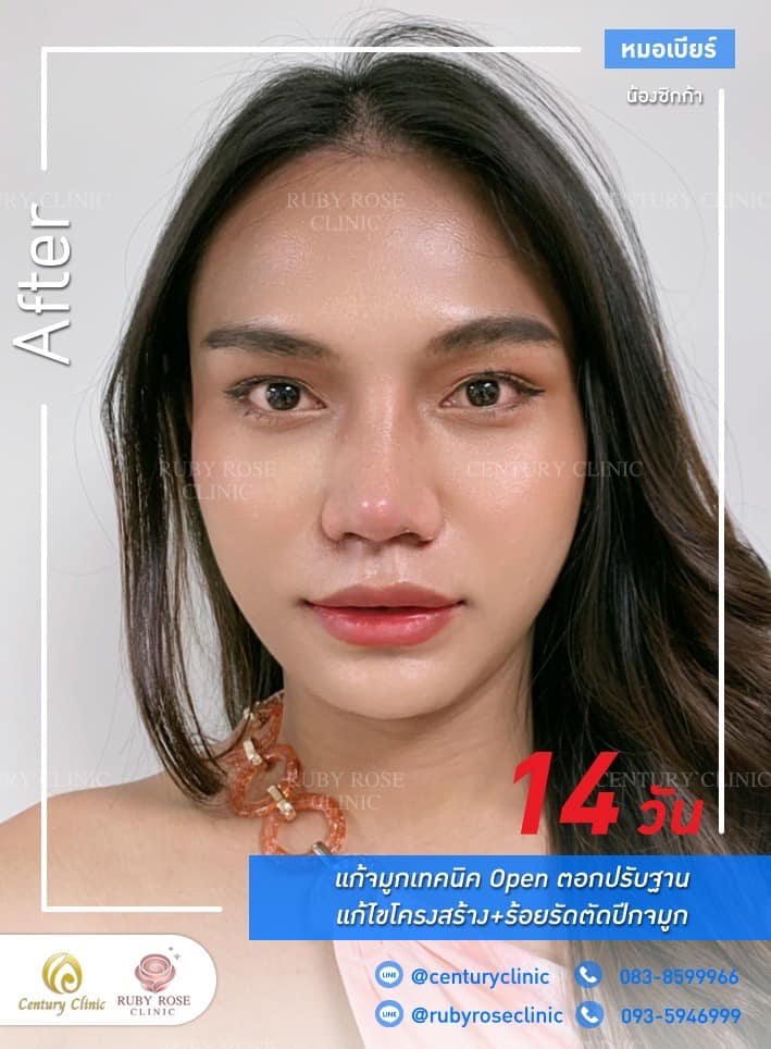 Century Clinic Thailand