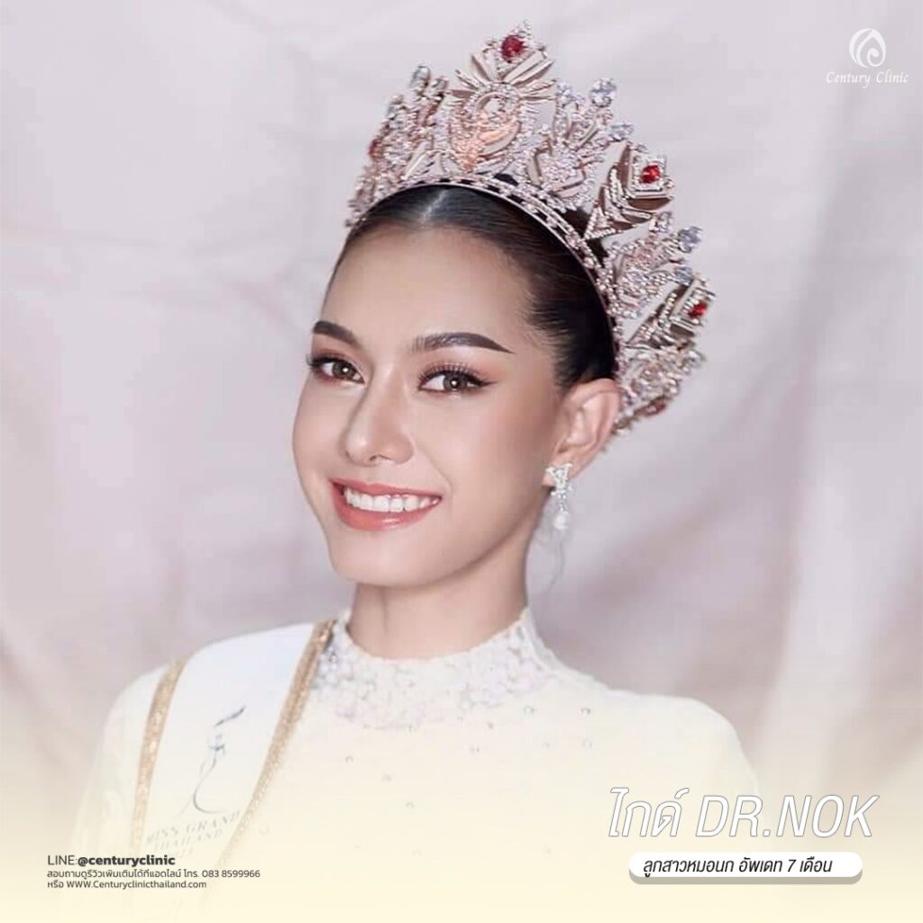 Century-รีวิว-แก้จมูก 1#541