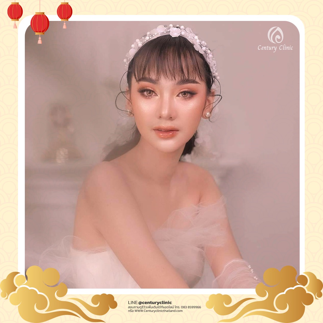 Century-รีวิว-แก้จมูก 1#547