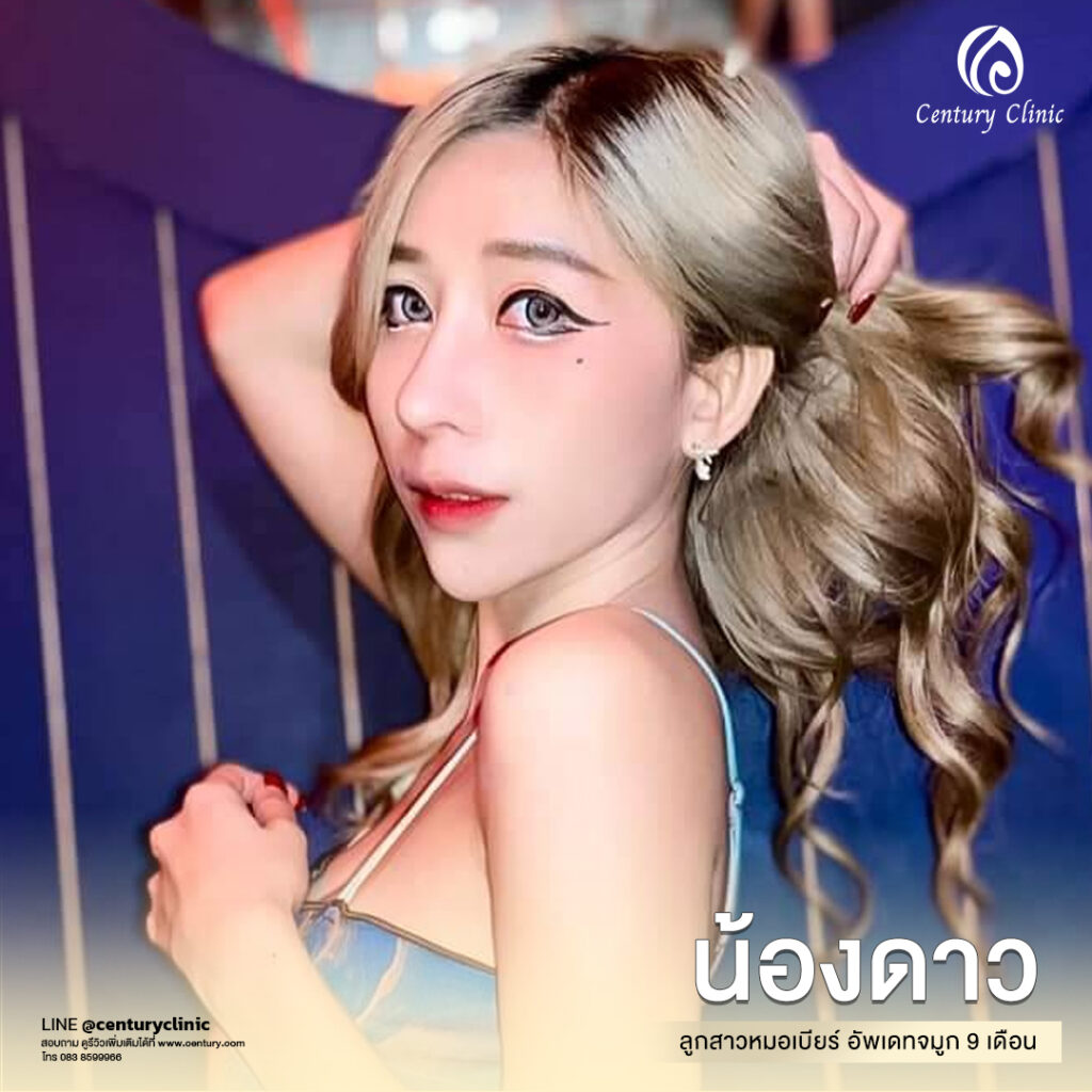 Century-รีวิว-แก้จมูก 1#557