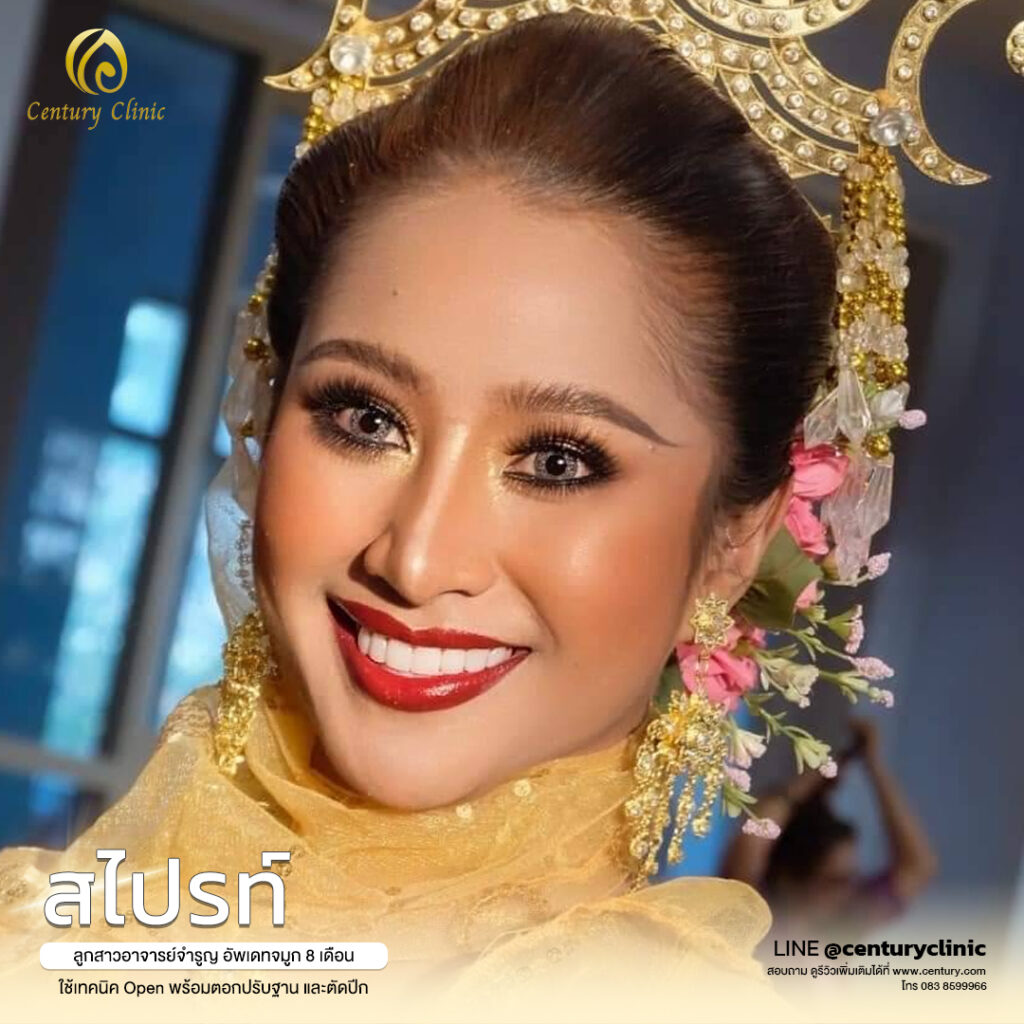 Century-รีวิว-แก้จมูก 1#559
