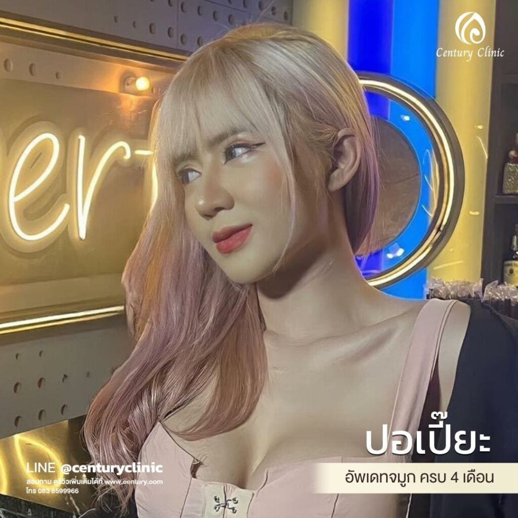 Century-รีวิว-แก้จมูก 1#564
