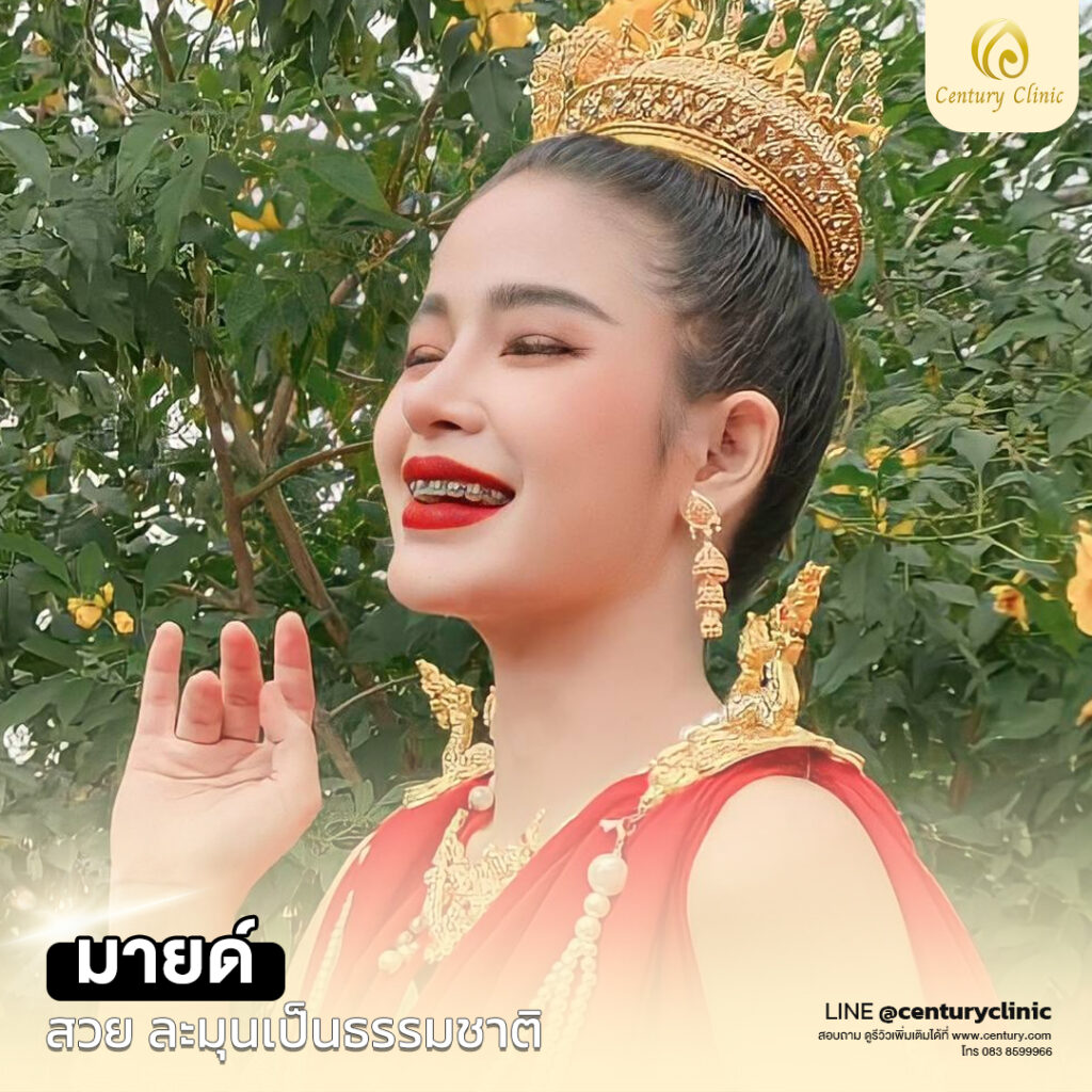 รีวิว แก้จมูก #539 , Century Clinic Thailand Century-รีวิว-แก้จมูก 2#539