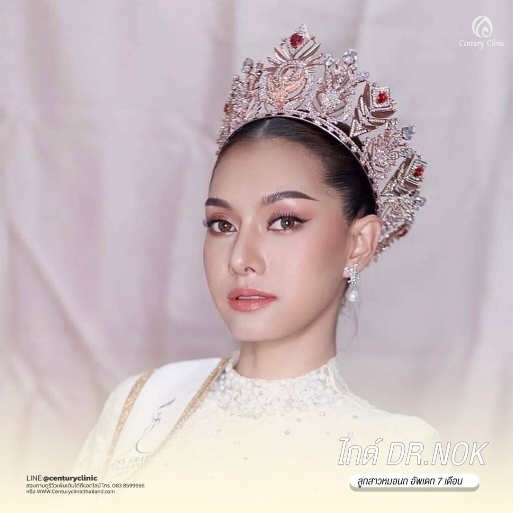 Century-รีวิว-แก้จมูก 2#541