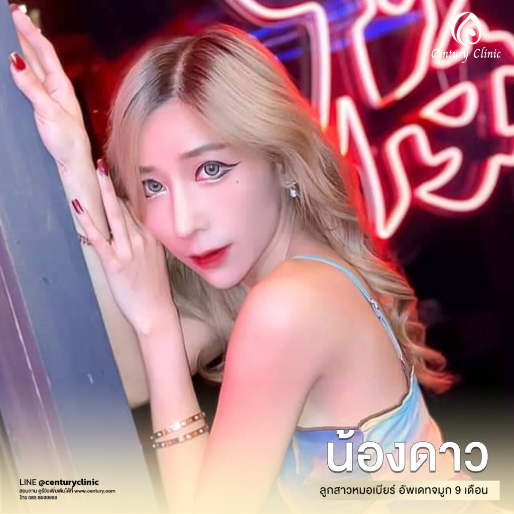 Century-รีวิว-แก้จมูก 2#557