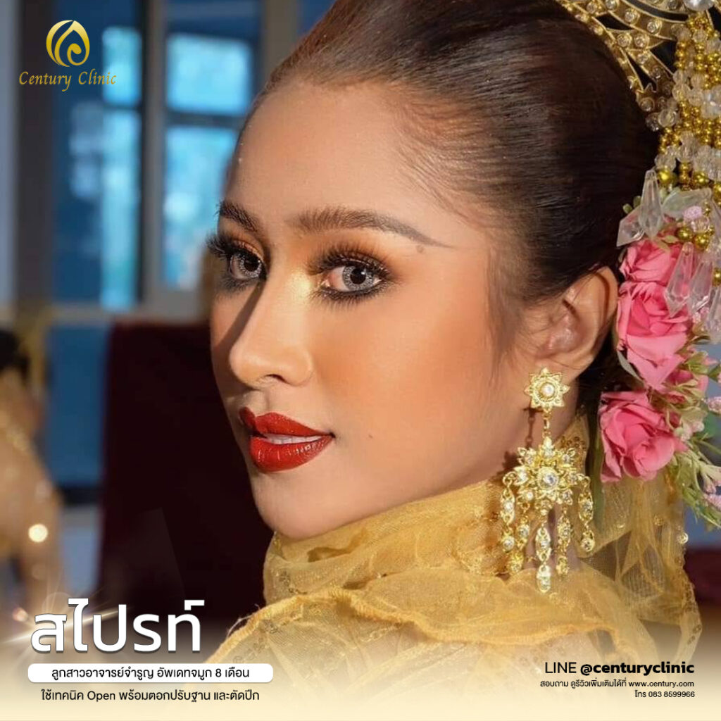 Century-รีวิว-แก้จมูก 2#559