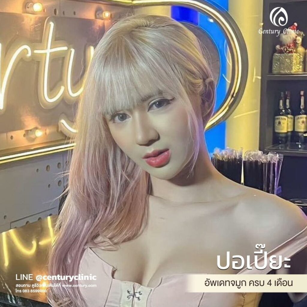Century-รีวิว-แก้จมูก 2#564