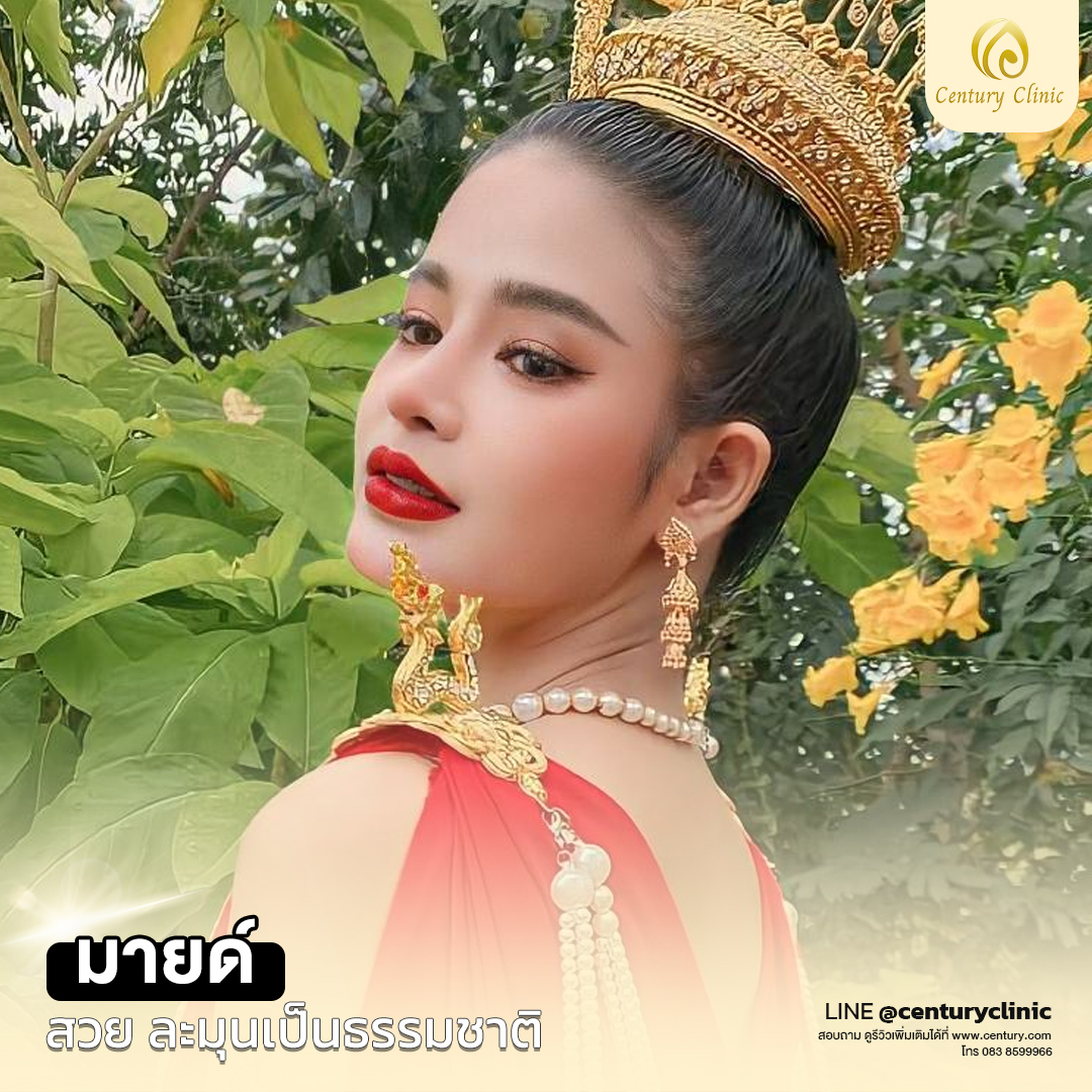 รีวิว แก้จมูก #539 , Century Clinic Thailand Century-รีวิว-แก้จมูก #539