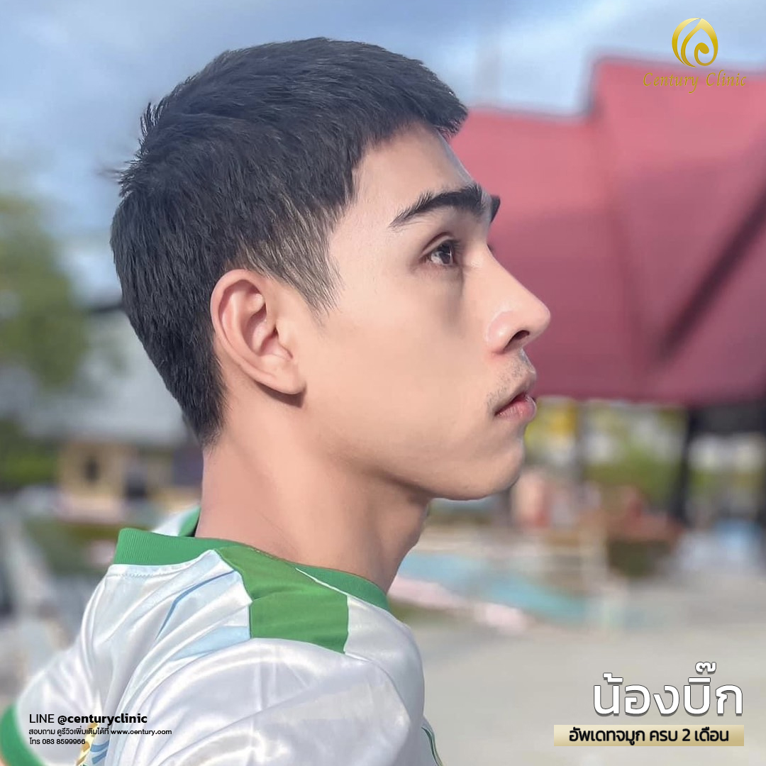Century-รีวิว-แก้จมูก #552