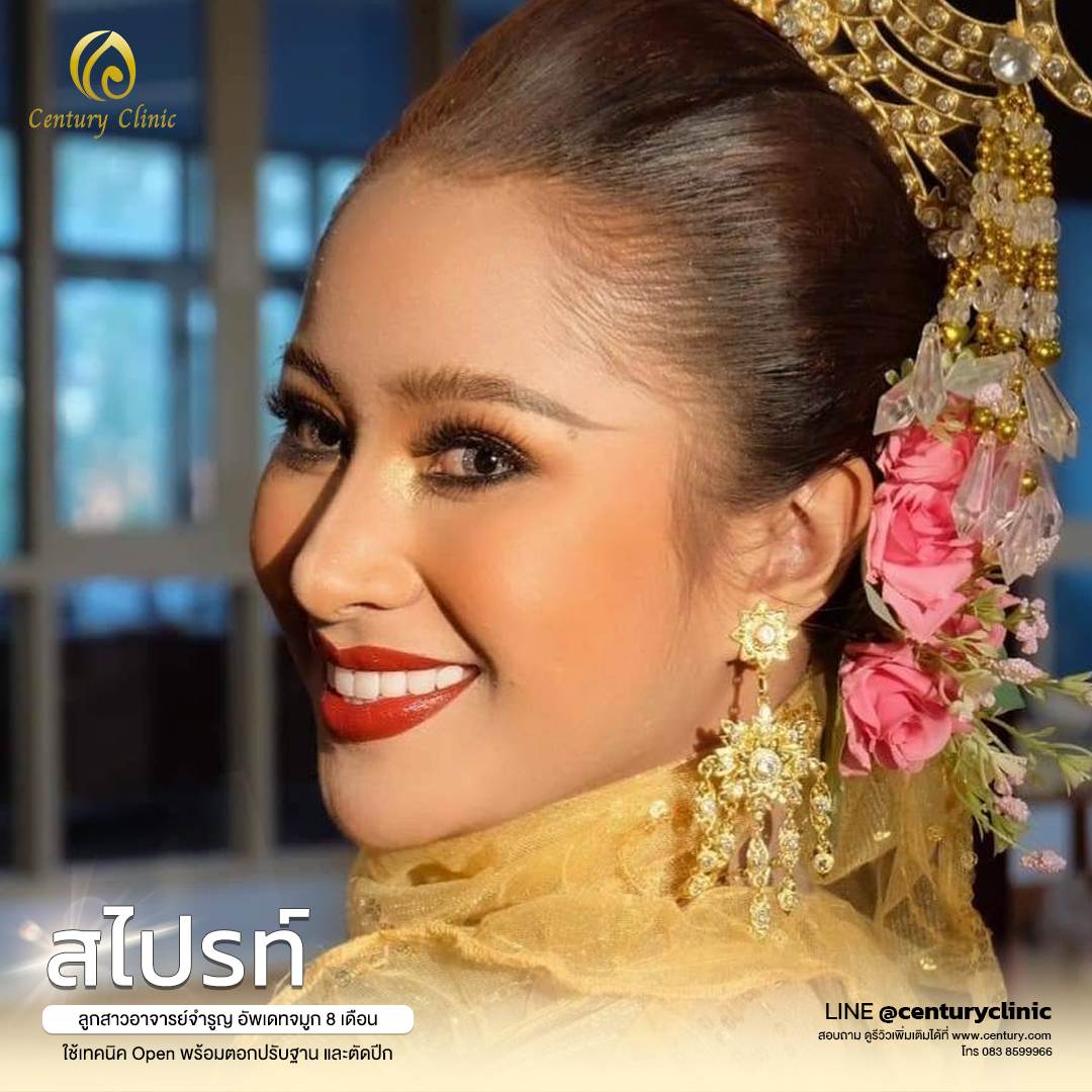 Century-รีวิว-แก้จมูก #559
