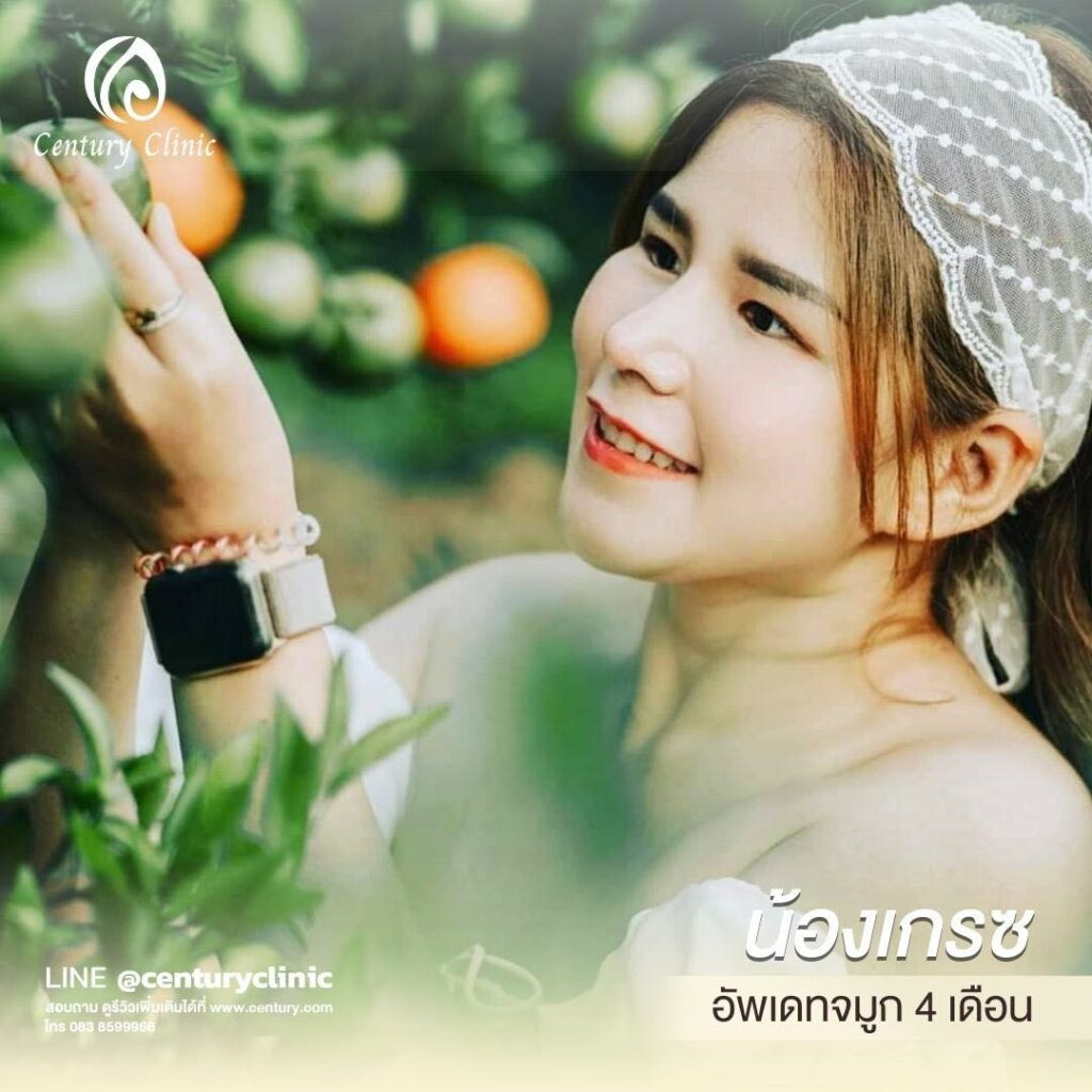 Century-รีวิว-แก้จมูก #571