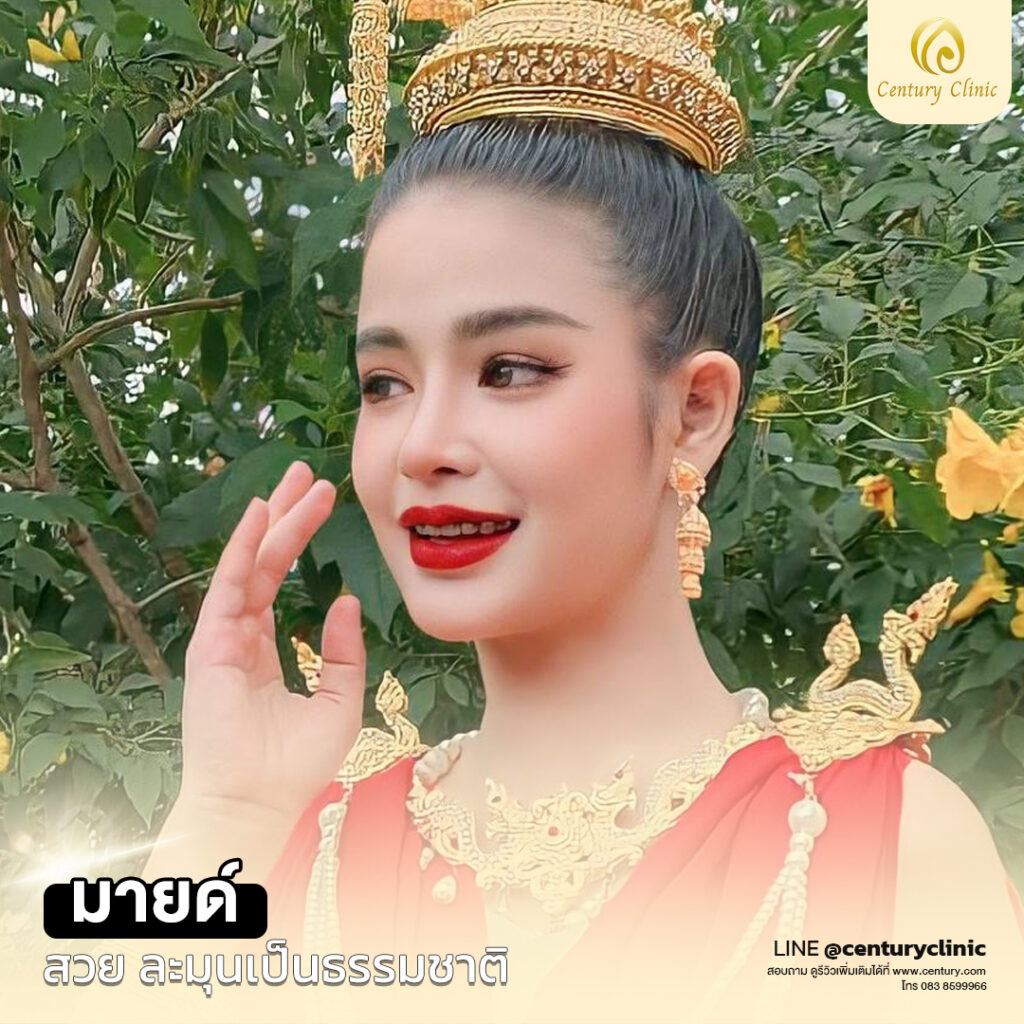 รีวิว แก้จมูก #539 , Century Clinic Thailand Century-รีวิว-แก้จมูก1#539