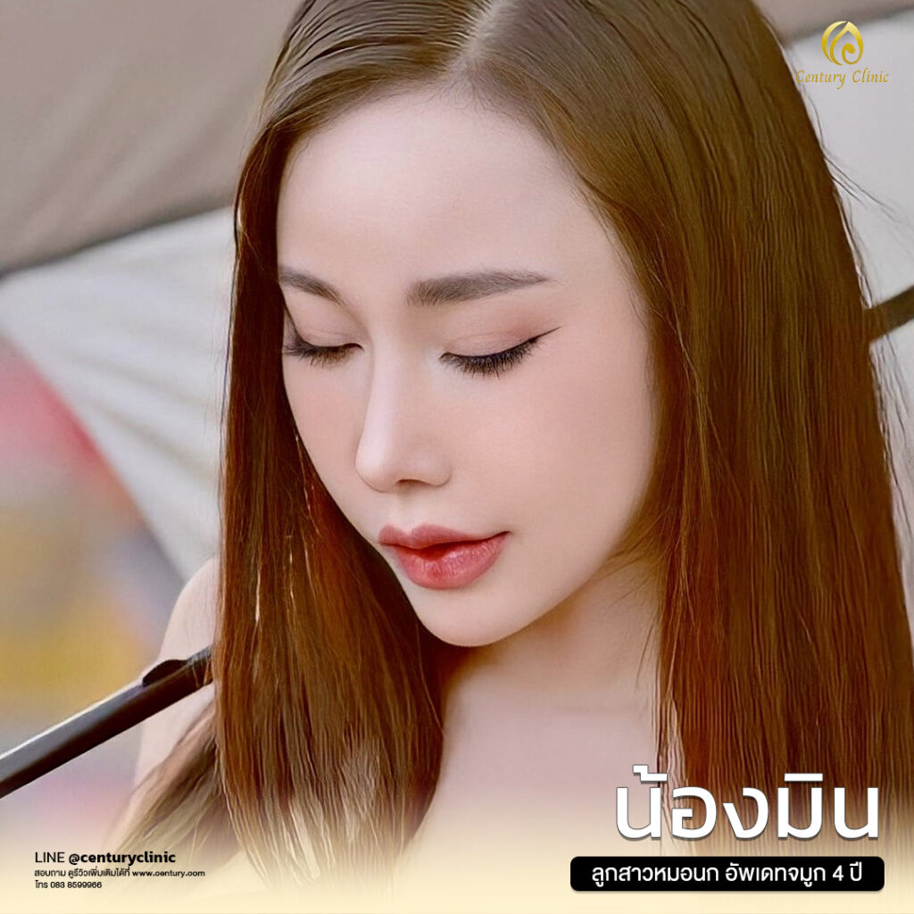 Century-รีวิว-เสริมจมูก 1#608