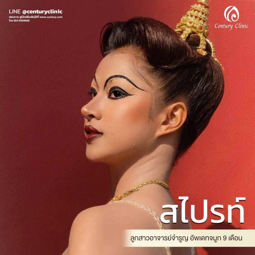 Century-รีวิว-เสริมจมูก 1#620
