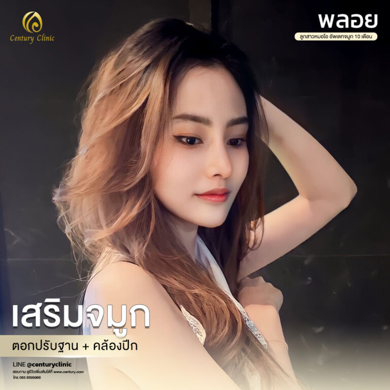 Century-รีวิว-เสริมจมูก #590