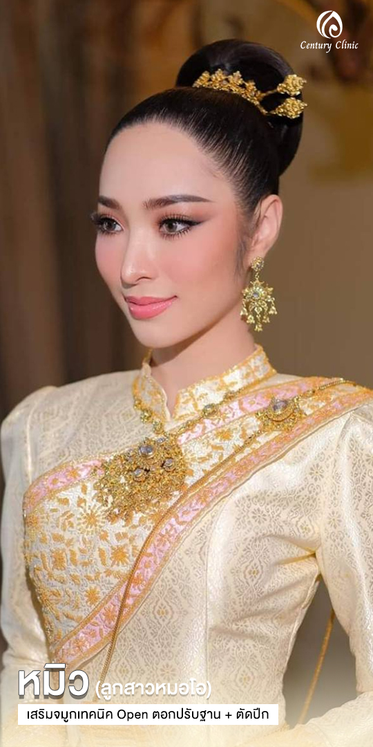 Century-รีวิว-เสริมจมูก #600
