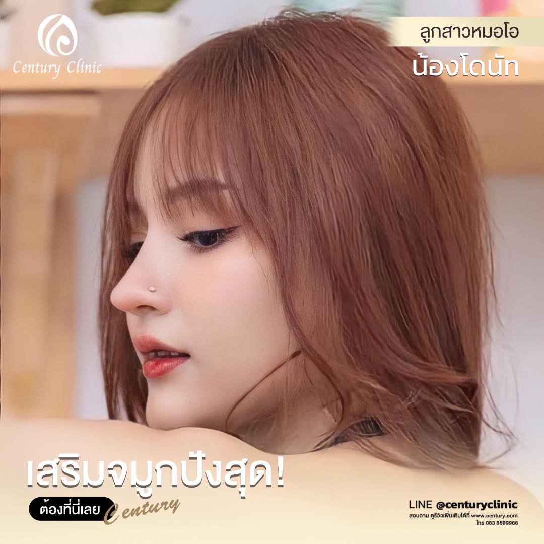รีวิว แก้จมูก #611 , Century Clinic Thailand Century-รีวิว-เสริมจมูก #611