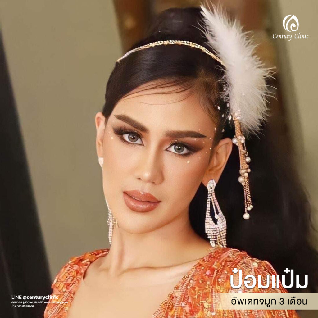 รีวิว แก้จมูก #578 , Century Clinic Thailand Century-รีวิว-แก้จมูก 1#578