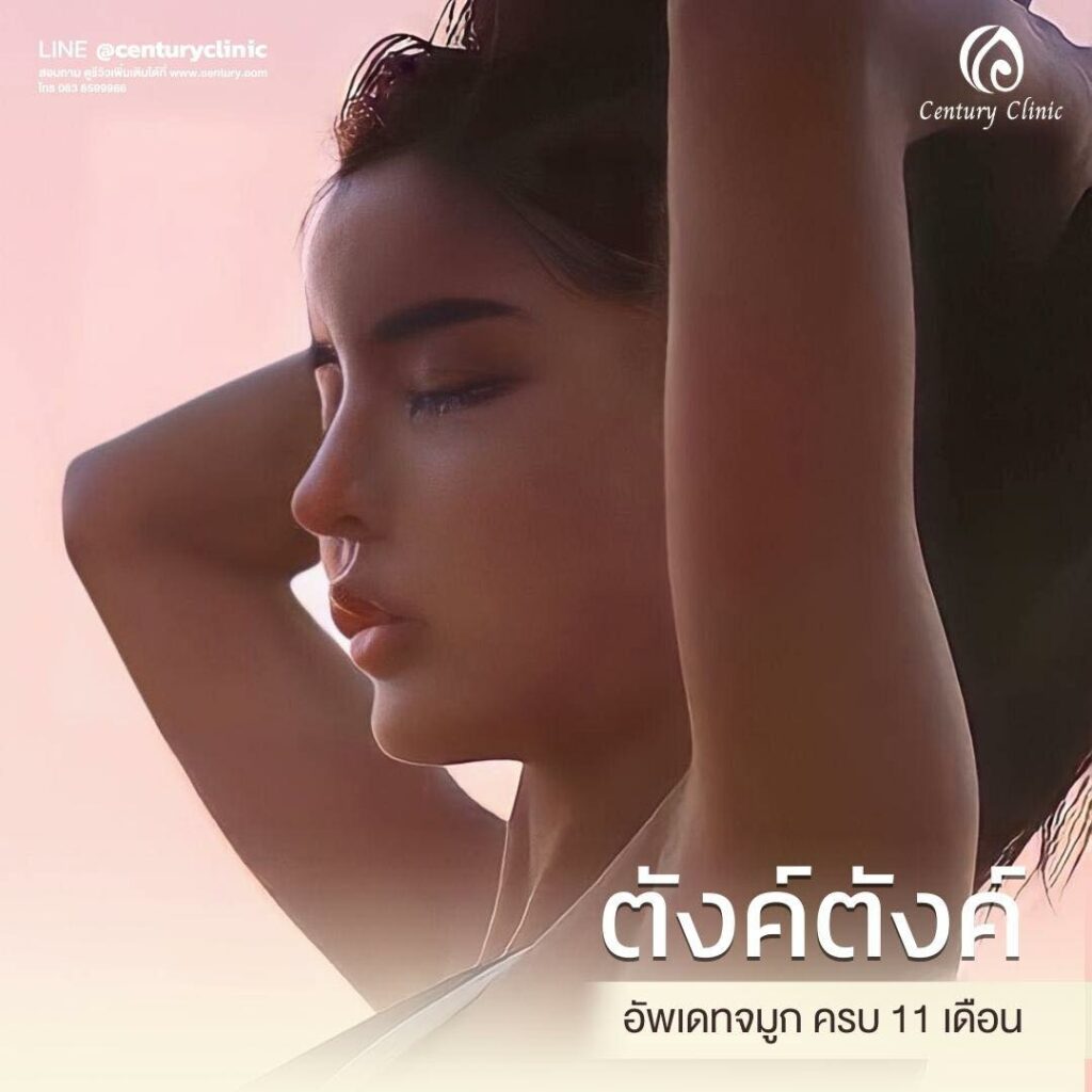 รีวิว แก้จมูก #584 , Century Clinic Thailand Century-รีวิว-แก้จมูก 1#584