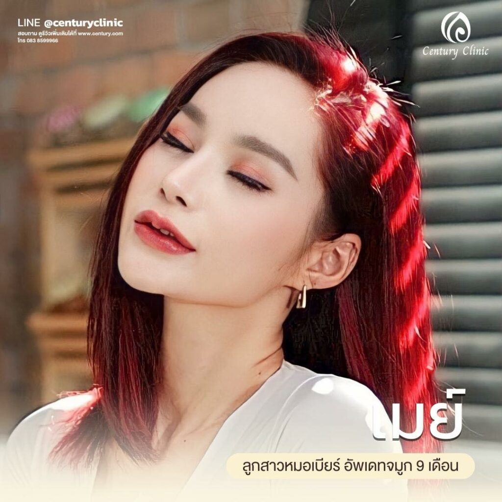 Century-รีวิว-แก้จมูก 1#585