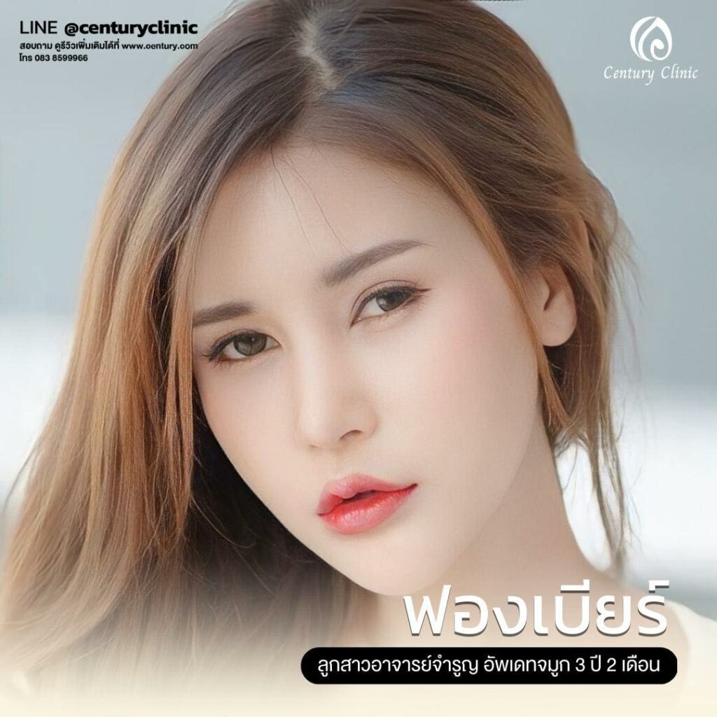 Century-รีวิว-แก้จมูก 1#614