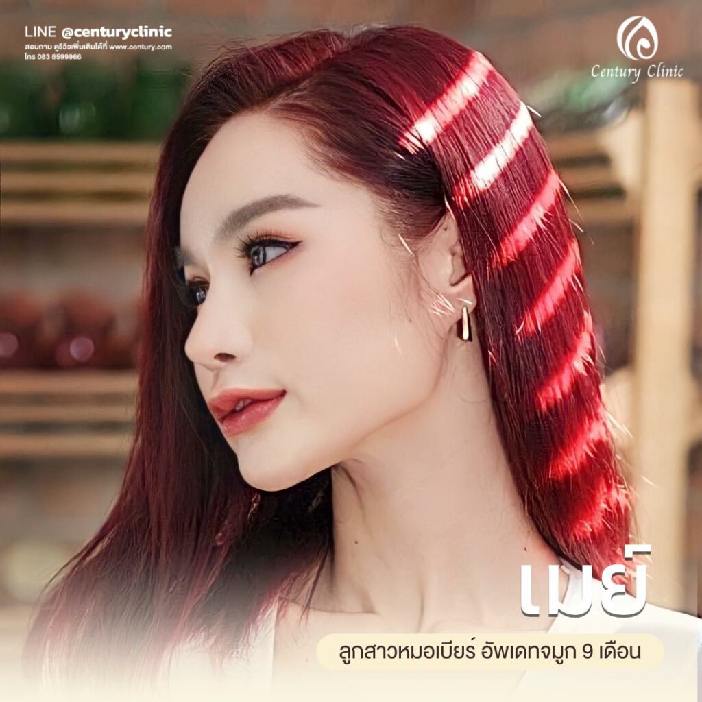 Century-รีวิว-แก้จมูก 2#585