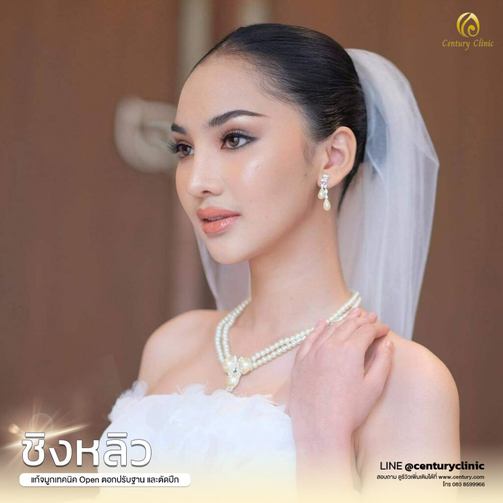 Century-รีวิว-แก้จมูก 2#599