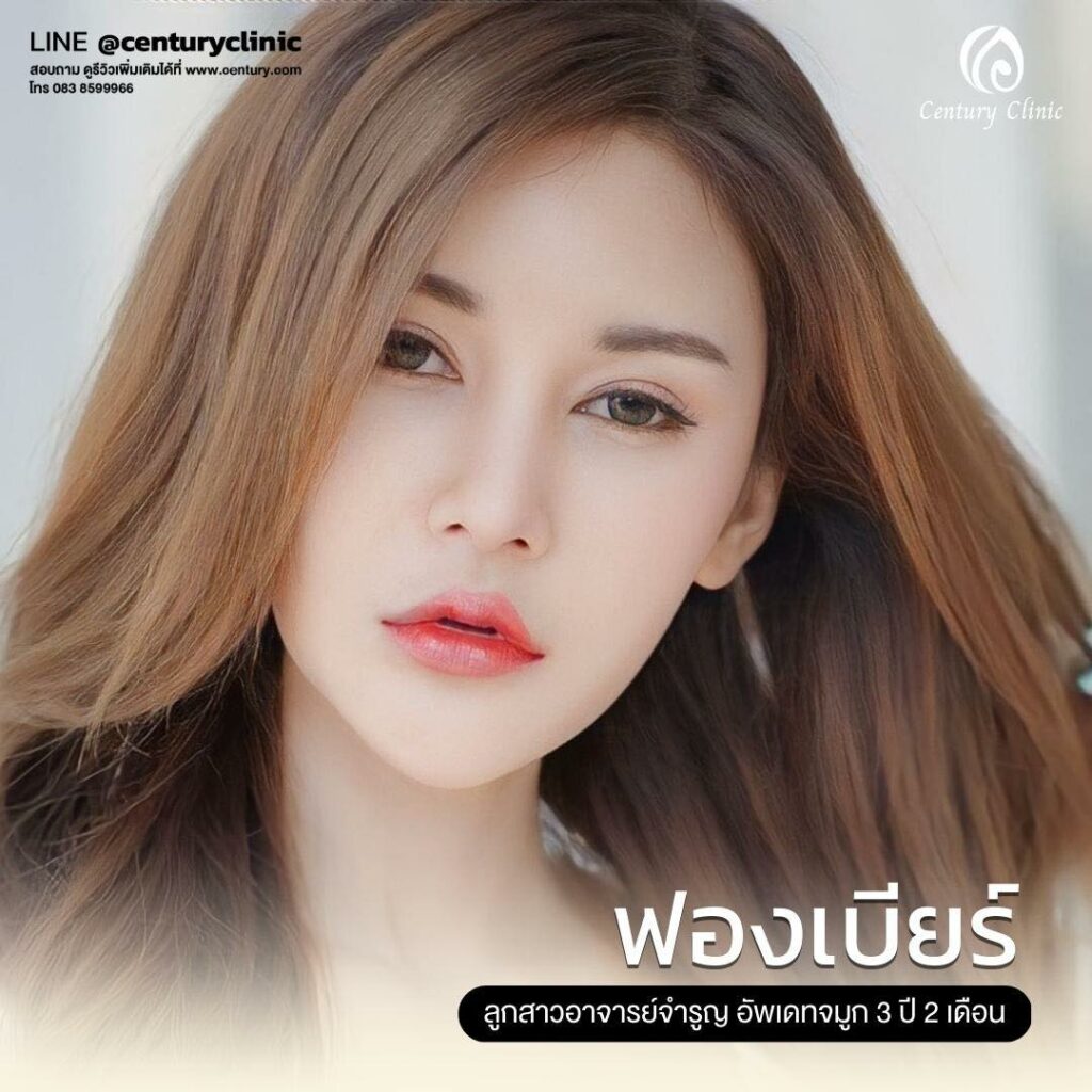 Century-รีวิว-แก้จมูก 2#614