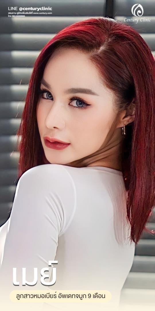 Century-รีวิว-แก้จมูก #585