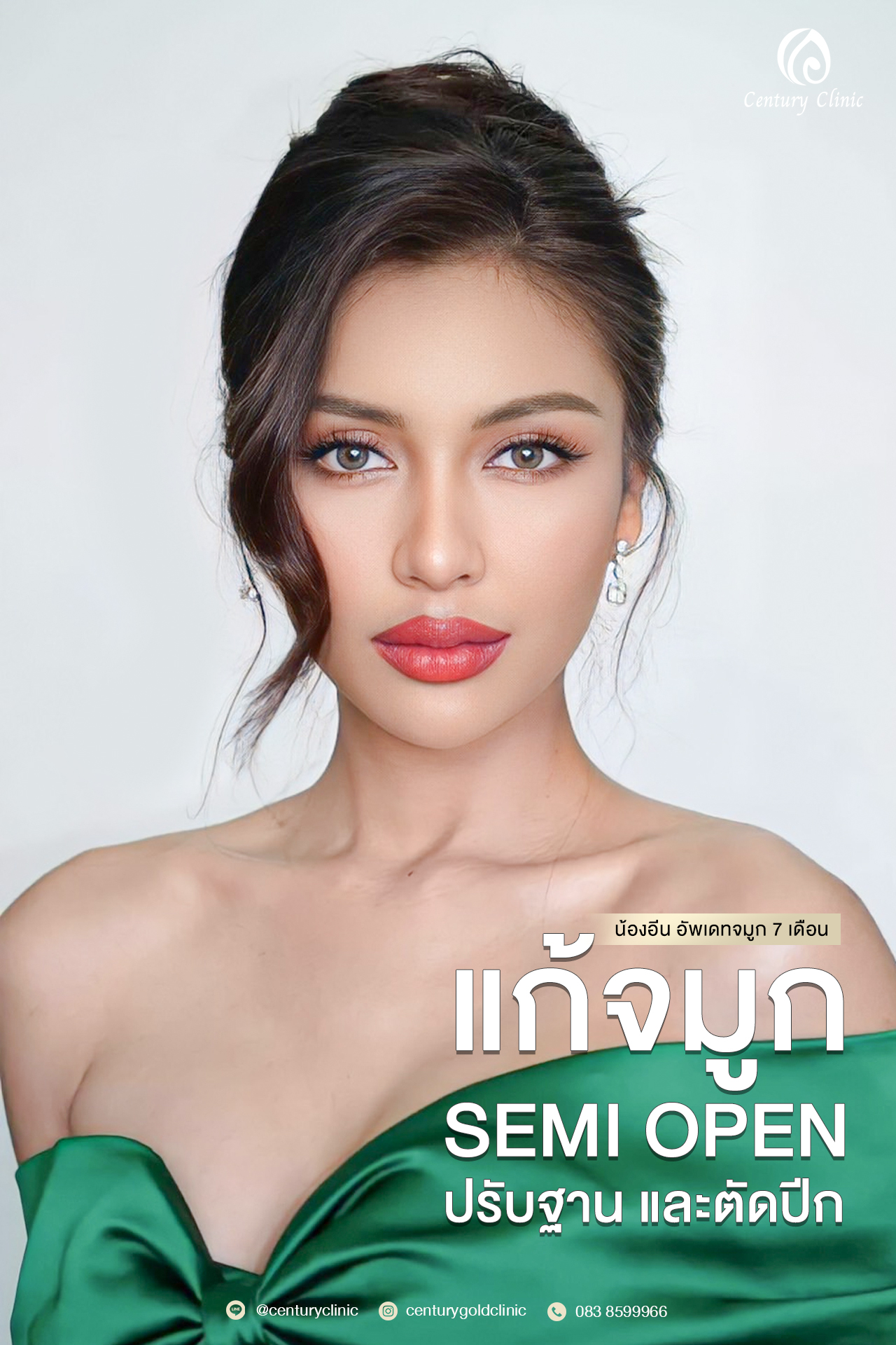 Century-รีวิว-แก้จมูก #589