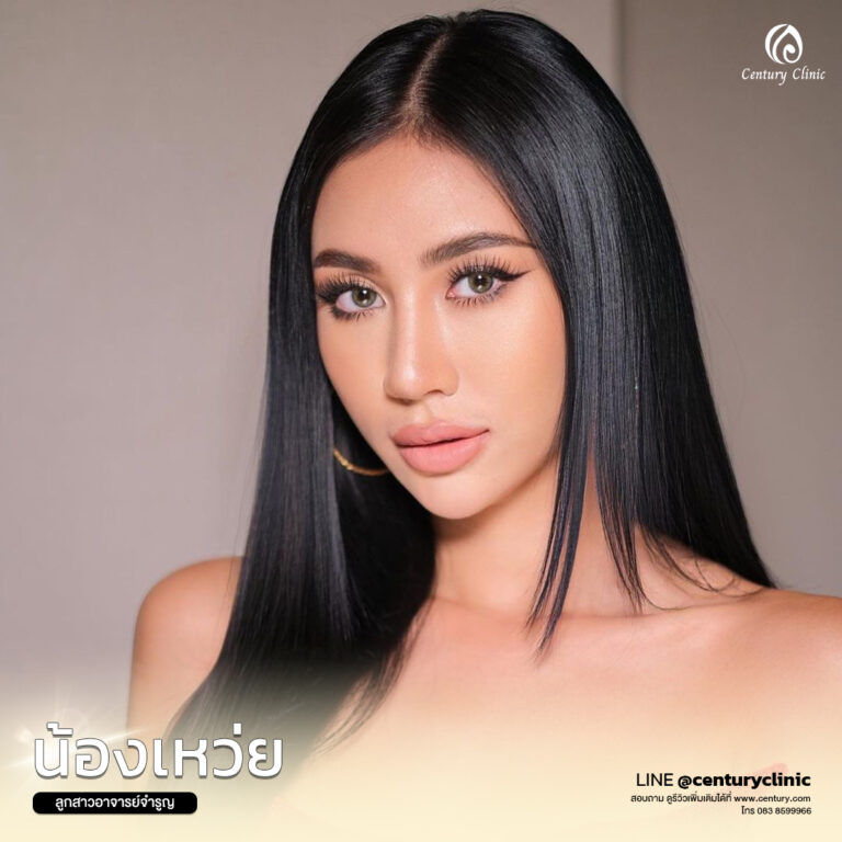 Century-รีวิว-แก้จมูก #597
