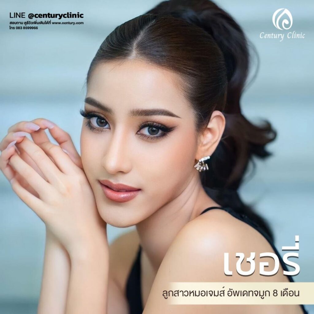 Century-รีวิว-เสริมจมูก 1#625