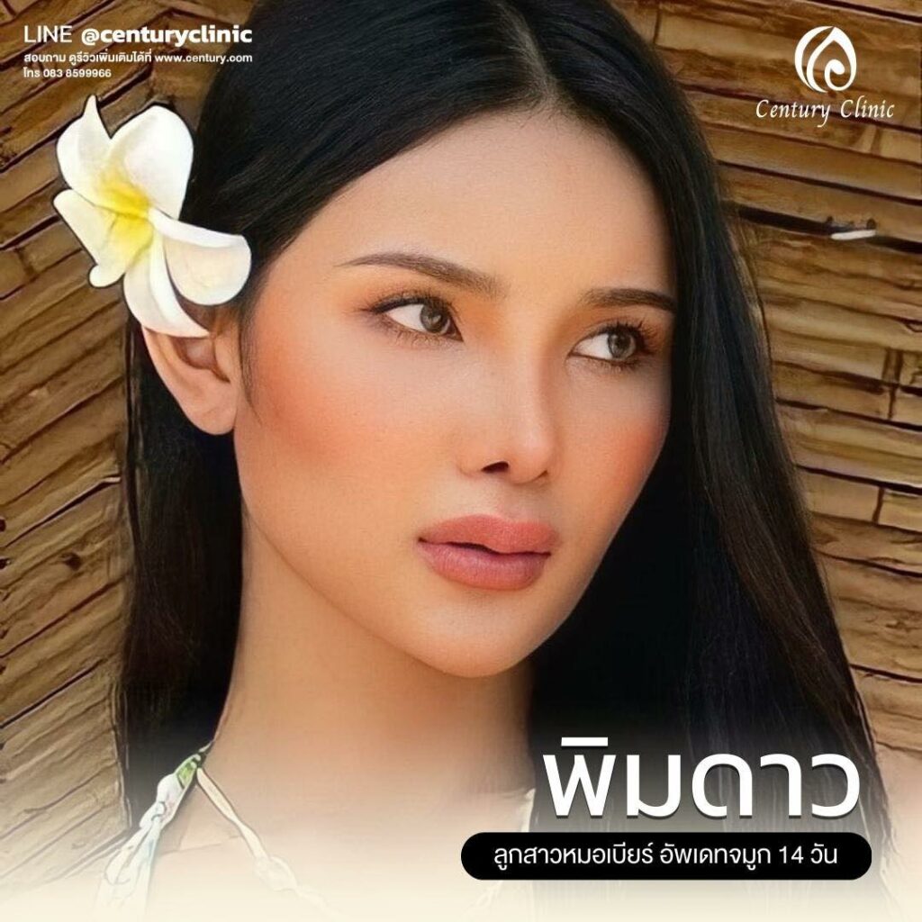 Century-รีวิว-เสริมจมูก 1#636