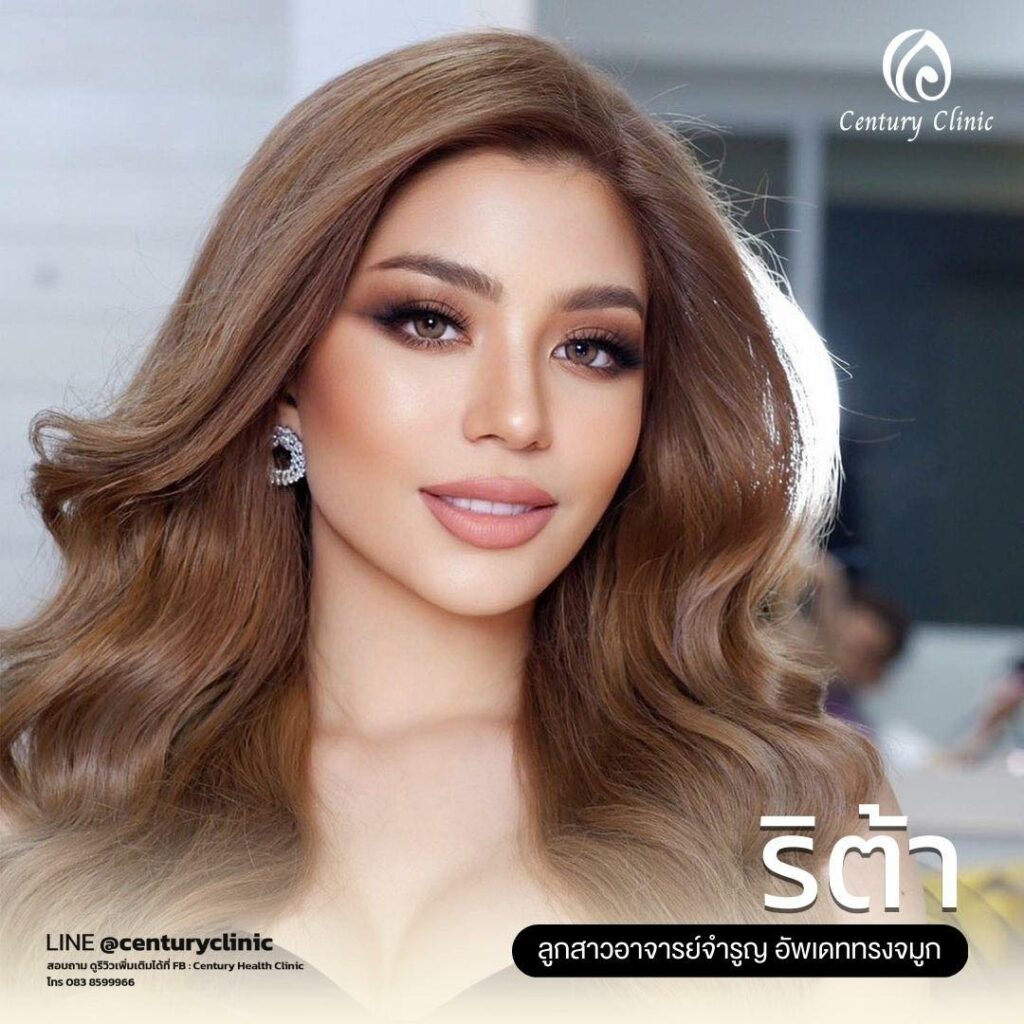 รีวิว เสริมจมูก #651 , Century Clinic Thailand Century-รีวิว-เสริมจมูก 1#651