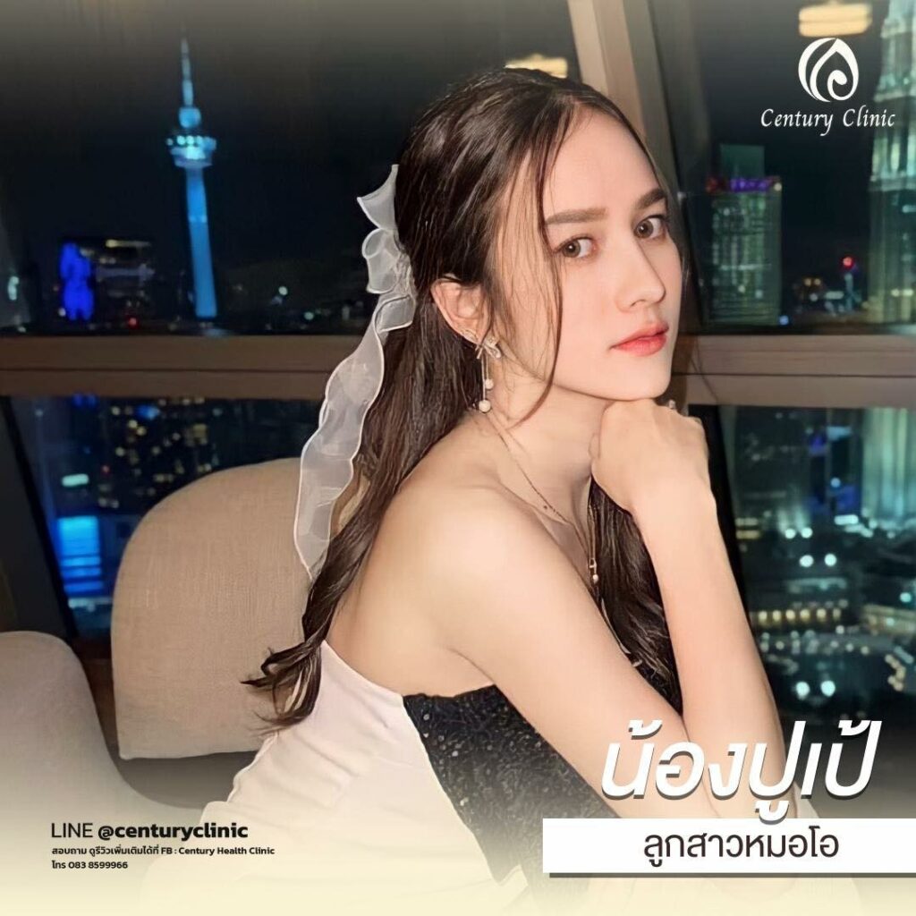 Century-รีวิว-เสริมจมูก 1#653